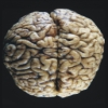 brain